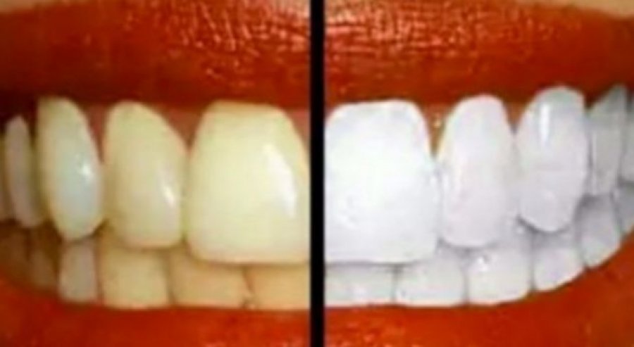 auto_dhembet_1536040712-97097831536158227