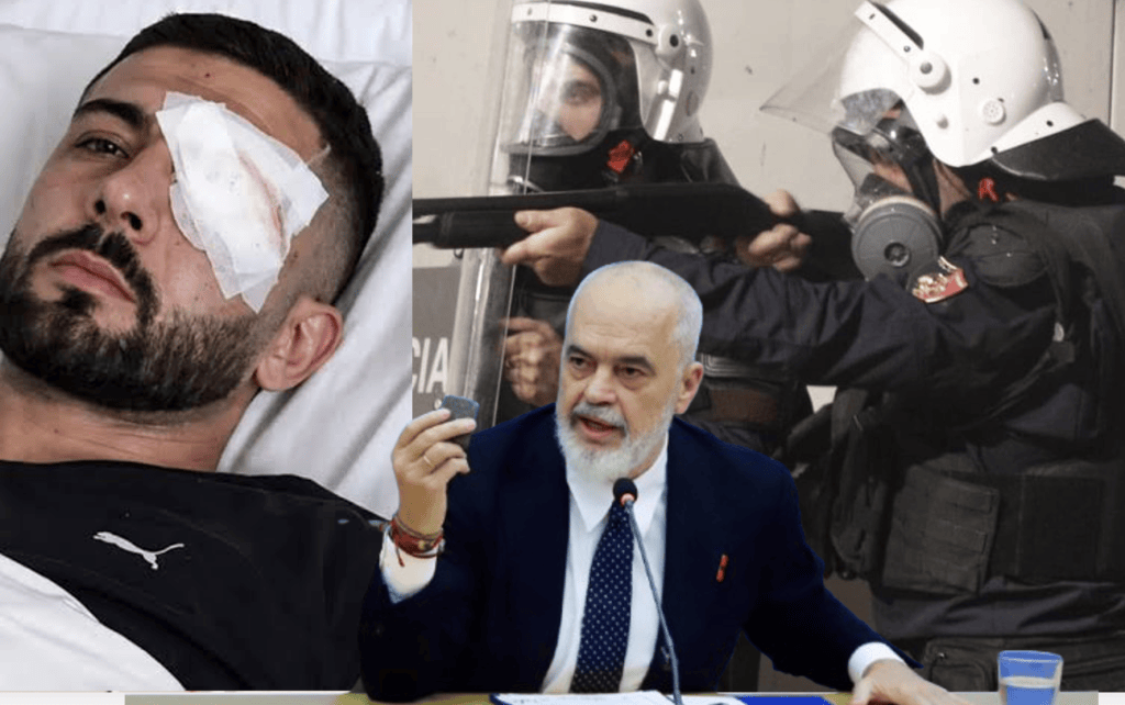 Miratohet paketa e Ramës për të shtypur protesën, të gjitha penalitetet për pjesëmarrje në&nbsp;tubime